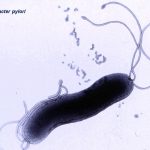 Helicobacter pylori