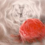 Cancro colorectal